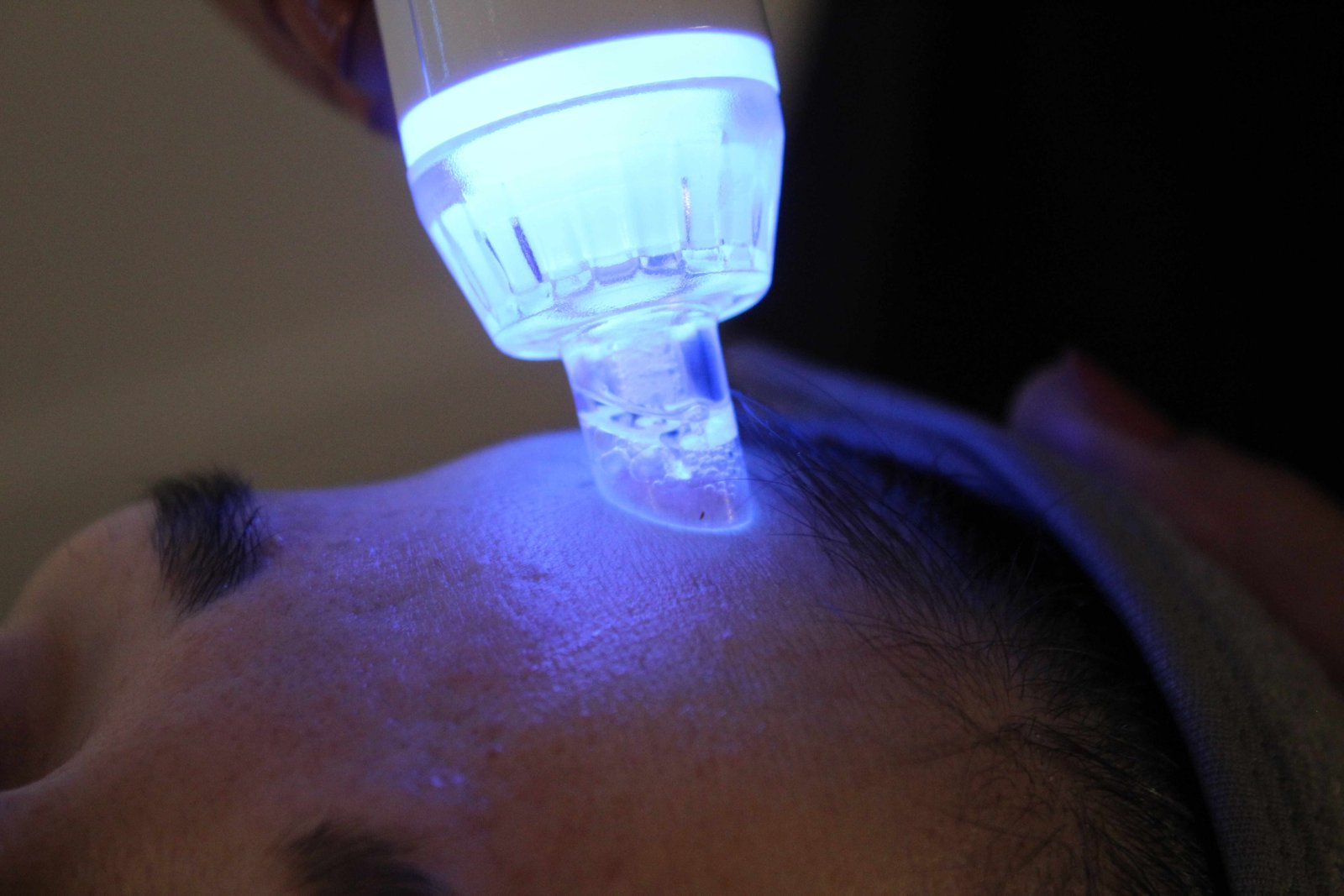 Tratamientos Faciales